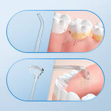 Dentaltriza Water Dental Flosser